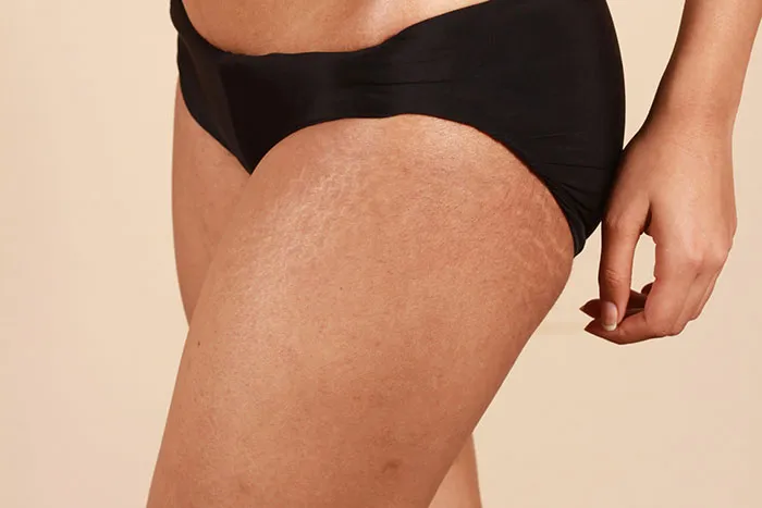 Men Are Sharing Things Their GFs Dislike About Themselves, But They Find Attractive (40 Answers)