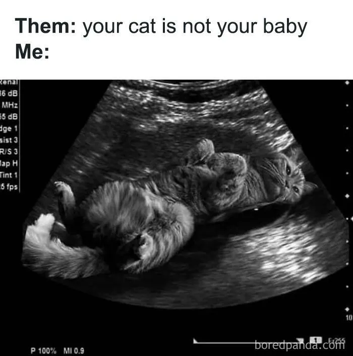 Ultrasound image showing a cat, humorously relatable meme.