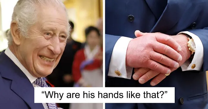 “Glad He Has A Sense Of Humor”: King Charles Roasts His Own Fingers In New BBC Documentary