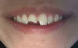 50 People Probably Having A Worse Day Than You On New Year’s