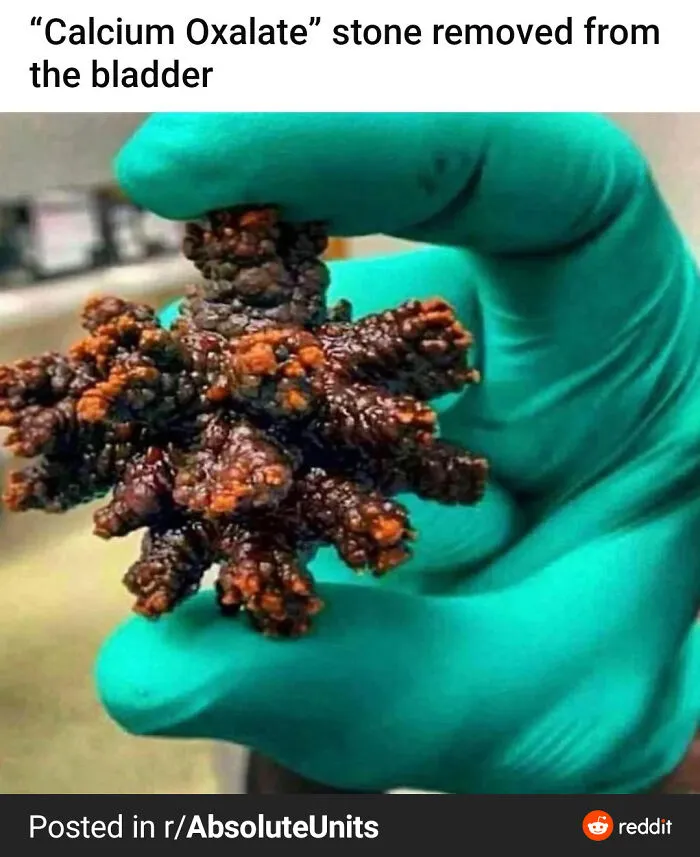 Can't Imagine The Pain