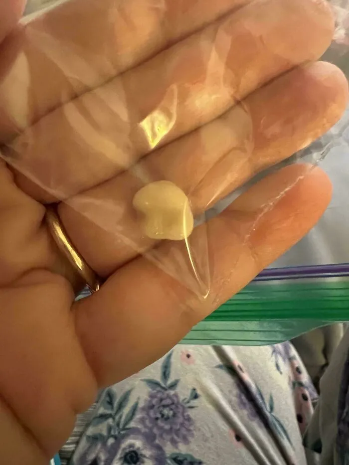 Dental Crown Popped Off At 10:30p New Years Eve. Yay