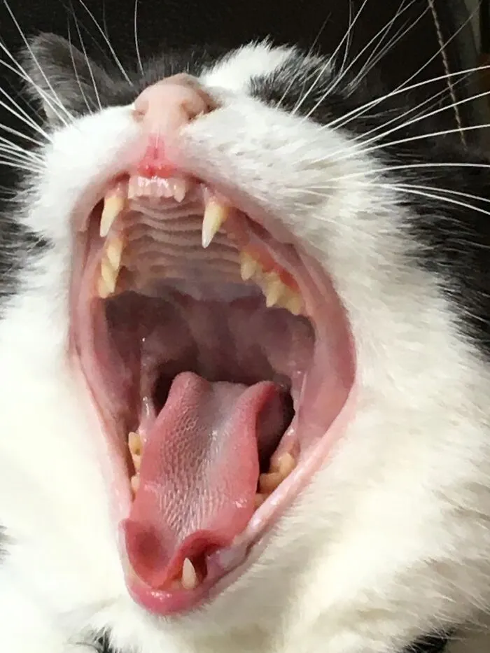 Yawn