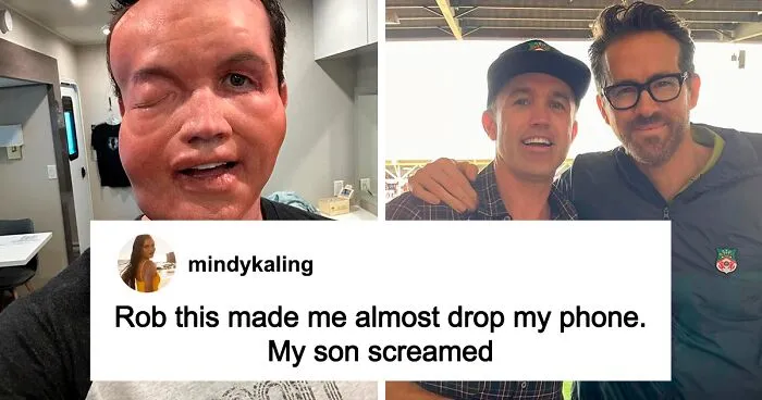 Rob McElhenney’s Fans Disturbed As Actor Shares New Year’s Eve Photo Of His “Swollen” Face
