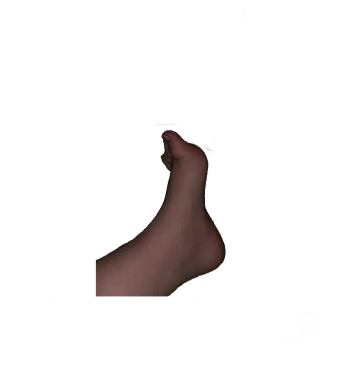 Worst Part Is I Don’t Even Know Whose Foot This Is!