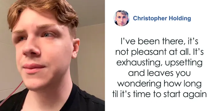 Man Who Underwent Skull Removal Surgeries To “Wash” His Brain Gets Denied Disability Benefits