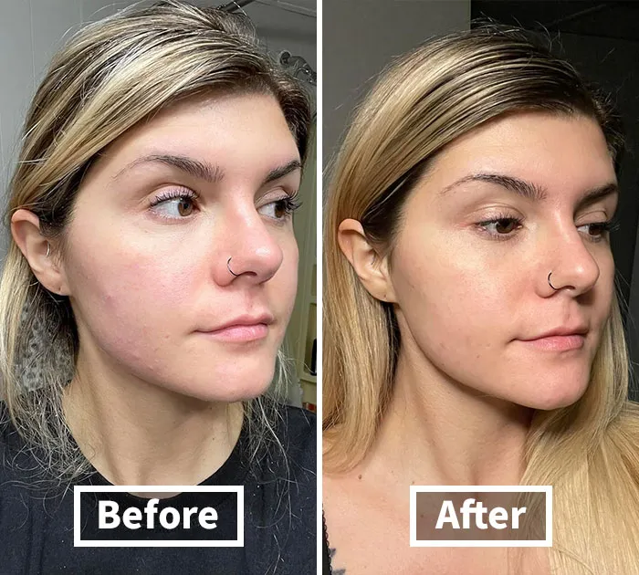 Meet Snail Mail You'll Actually Love! With <span Style="Font:inherit;color:#d74b1f;"> Cosrx Snail Mucin 96% Power Repairing Essence</Span>, Upgrade Your Skincare Routine So You Can Slide Into The Day With Silky Smooth Confidence