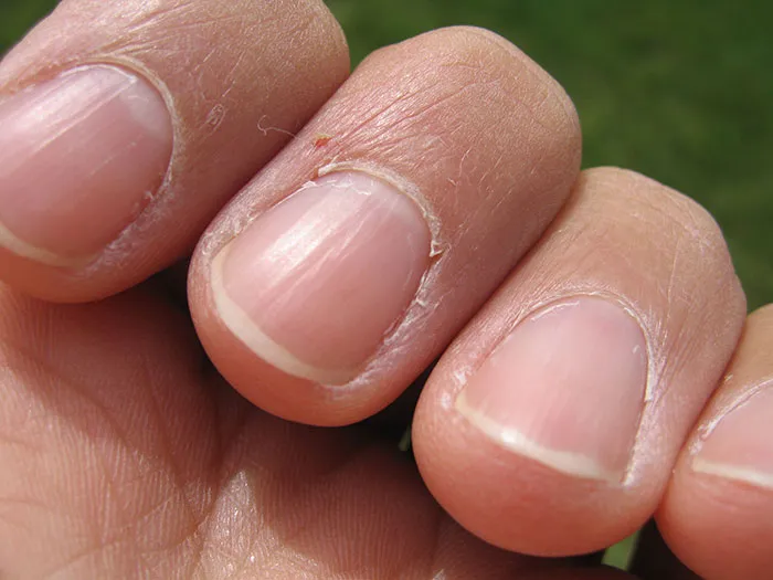 31 Common Hygiene Mistakes Everyone Should Be Aware Of For The Greater Good Of The Population