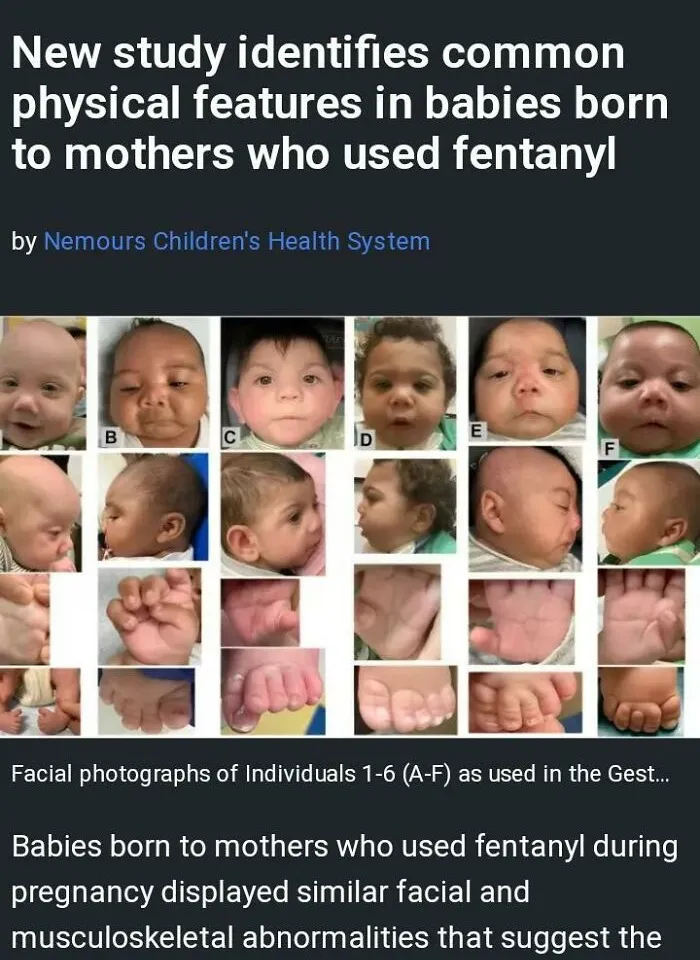 Possible New Fetal Syndrome