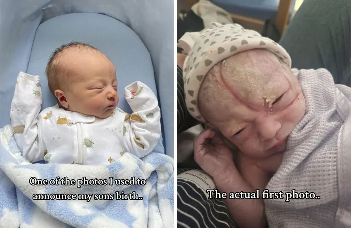 35 Parents Share Pics They Used To Announce Their Baby’s Birth Vs. What They Actually Looked Like