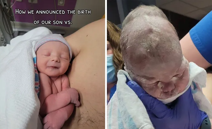 35 Parents Share Pics They Used To Announce Their Baby’s Birth Vs. What They Actually Looked Like