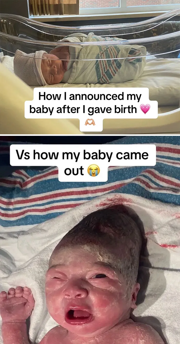 35 Parents Share Pics They Used To Announce Their Baby’s Birth Vs. What They Actually Looked Like