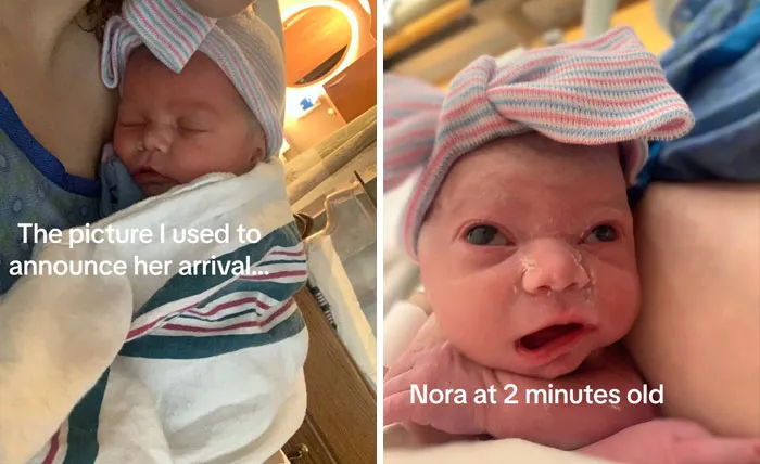 35 Parents Share Pics They Used To Announce Their Baby’s Birth Vs. What They Actually Looked Like