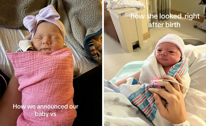 35 Parents Share Pics They Used To Announce Their Baby’s Birth Vs. What They Actually Looked Like