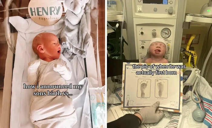 35 Parents Share Pics They Used To Announce Their Baby’s Birth Vs. What They Actually Looked Like