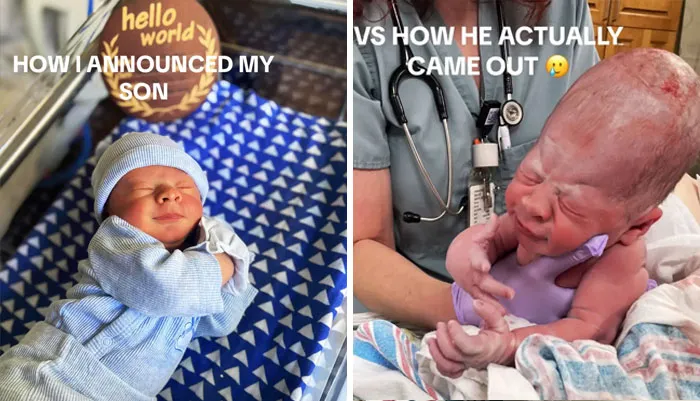 35 Parents Share Pics They Used To Announce Their Baby’s Birth Vs. What They Actually Looked Like