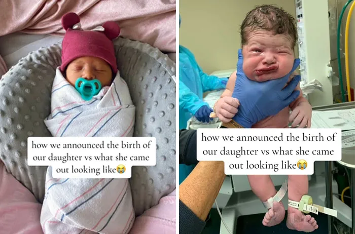 35 Parents Share Pics They Used To Announce Their Baby’s Birth Vs. What They Actually Looked Like