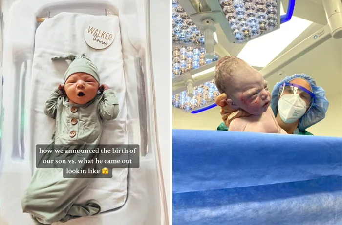 35 Parents Share Pics They Used To Announce Their Baby’s Birth Vs. What They Actually Looked Like