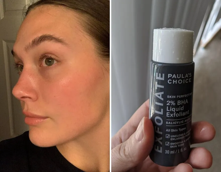 <span Style="Font:inherit;color:#d74b1f;"> Paula's Choice 2% Bha </Span>: Your Ultimate Defense Against Blackheads And Wrinkles