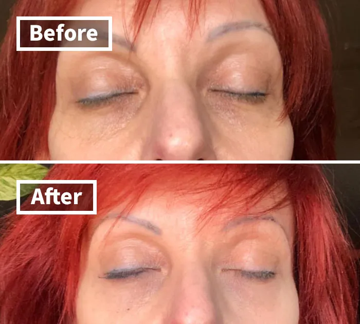 Say Goodbye To Dark Circles, Puffiness, And Wrinkles With <span Style="Font:inherit;color:#d74b1f;"> Lilyana Naturals Eye Cream</Span>