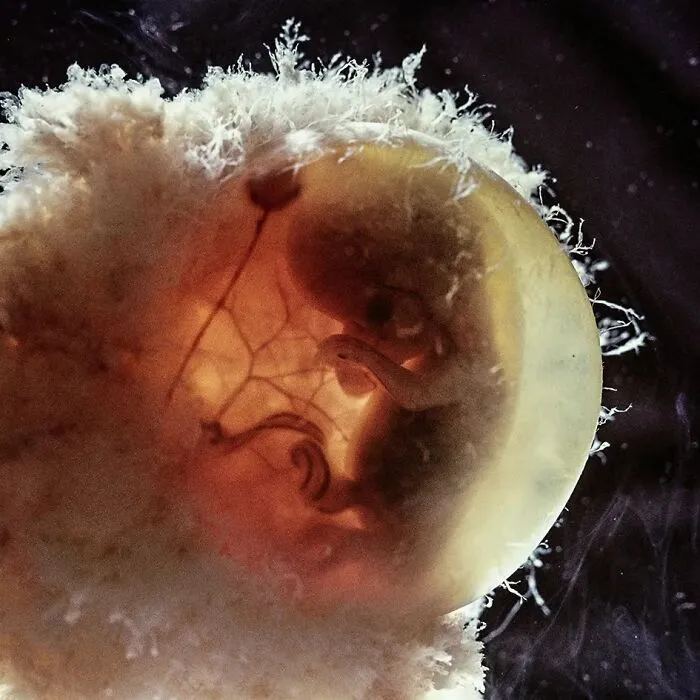 19 Groundbreaking Images By This Photographer Offering A Glimpse Into The Miracle Of Birth