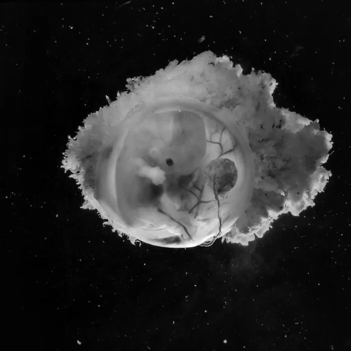 19 Groundbreaking Images By This Photographer Offering A Glimpse Into The Miracle Of Birth
