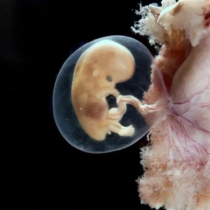 19 Groundbreaking Images By This Photographer Offering A Glimpse Into The Miracle Of Birth