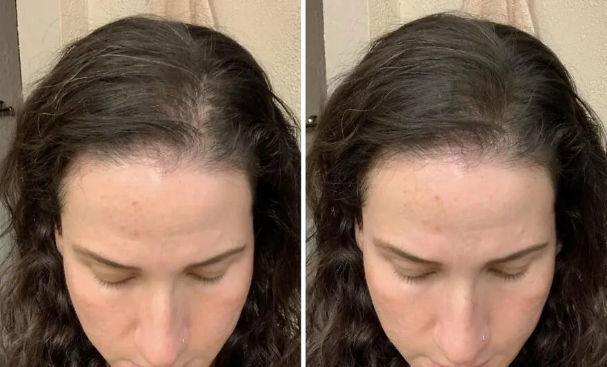 Root Rescue: <span Style="Font:inherit;color:#d74b1f;"> L'oreal Paris Magic Cover</Span> For Instant Touch-UPS!