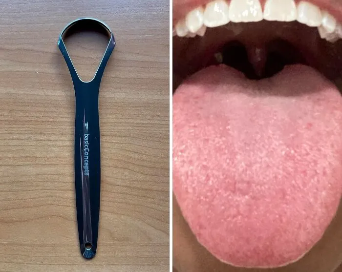 Refresh Your Oral Hygiene With Basic Concepts <span Style="Font:inherit;color:#d74b1f;"> Tongue Scraper</Span> For Adults