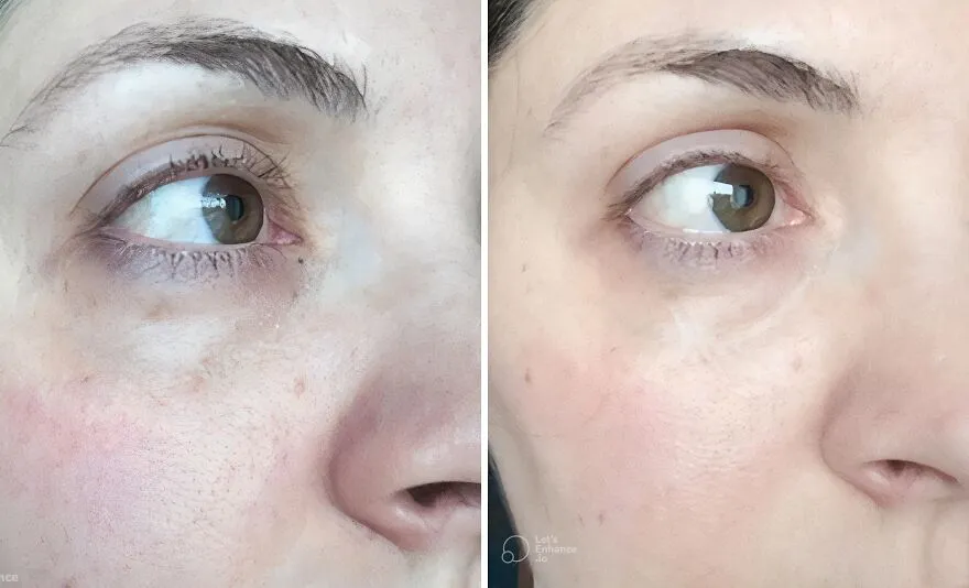 Ditch The Dark Circles: <span Style="Font:inherit;color:#d74b1f;"> Grace & Stella's Gel Eye Patches</Span> To The Rescue!
