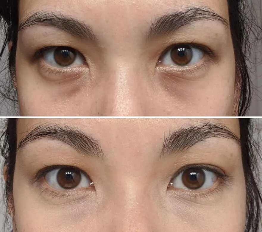 Instant Eye Refresh: <span Style="Font:inherit;color:#d74b1f;"> Maybelline Age Rewind Eraser</Span> For Dark Circle Rescue!