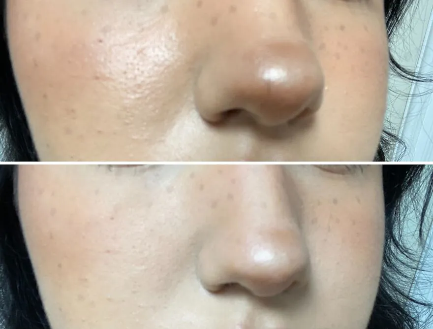 Roll Away The Shine: <span Style="Font:inherit;color:#d74b1f;"> Revlon's Volcanic Roller</Span> For Flawless Skin Anytime!