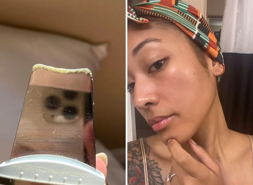 Blackhead Banisher: <span Style="Font:inherit;color:#d74b1f;"> Gugug’s Gentle Touch </Span> For Pure Pores!