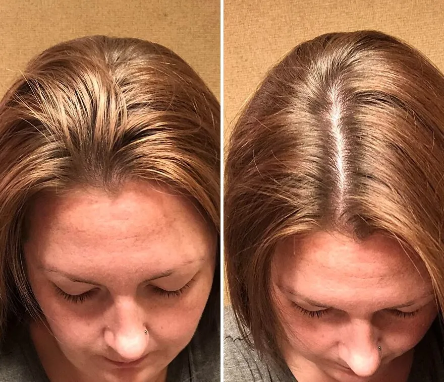 From Flat To Fab: <span Style="Font:inherit;color:#d74b1f;"> Handmade Heroes Dry Shampoo</Span> For Instant Freshness!