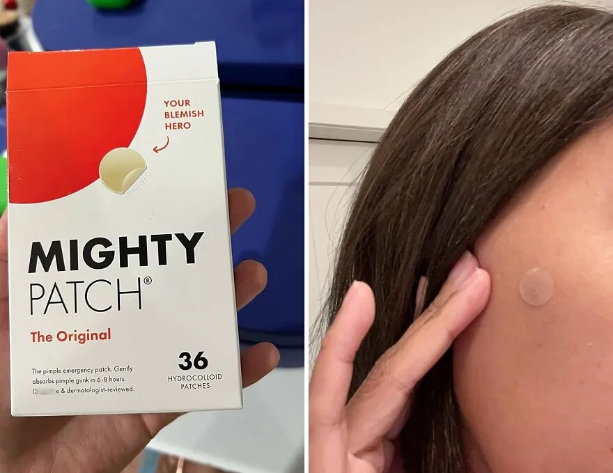 Achieve Clear, Blemish-Free Skin With Must Have Acne <span Style="Font:inherit;color:#d74b1f;"> Pimple Patches </Span>