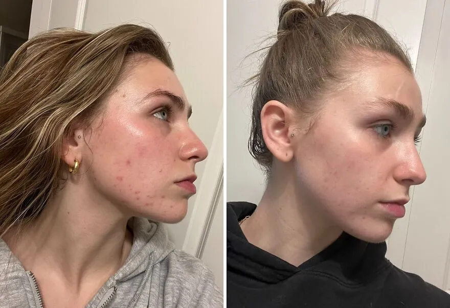 Smooth, Brighten, Refine: <span Style="Font:inherit;color:#d74b1f;"> Cerave's Serum </Span> Tackles Textures & Pores!