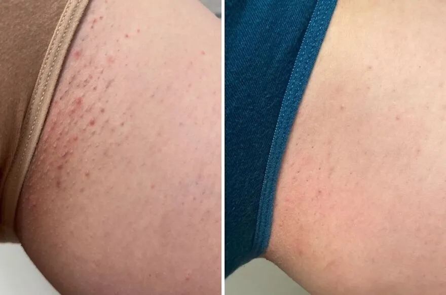 Smooth Sailing: <span Style="Font:inherit;color:#d74b1f;"> Bushbalm Oil</Span> For Your Best Skin, Bye Ingrowns & Redness!