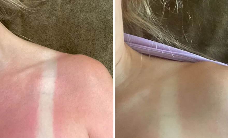 Soothe Your Sun-Kissed Skin With <span Style="Font:inherit;color:#d74b1f;"> Solar Recover's Hydrating Spray</Span>!