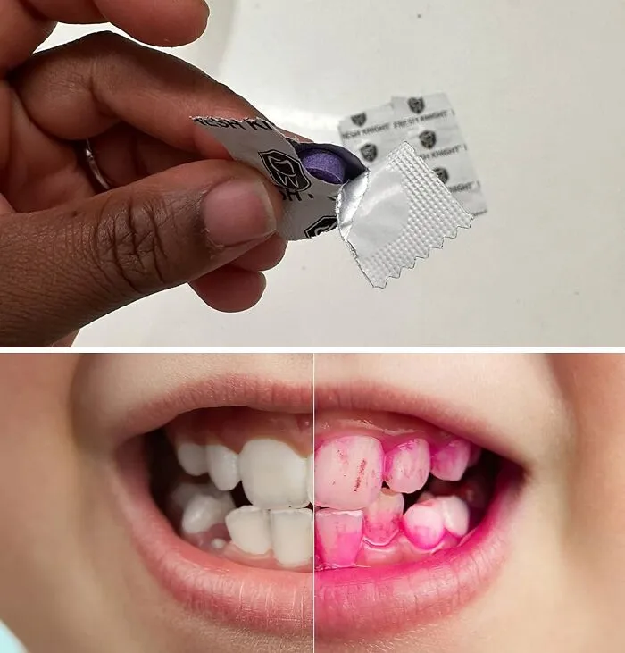 Tooth Truths Unveiled:<span Style="Font:inherit;color:#d74b1f;"> Fresh Knight’s Plaque Reveal</Span>