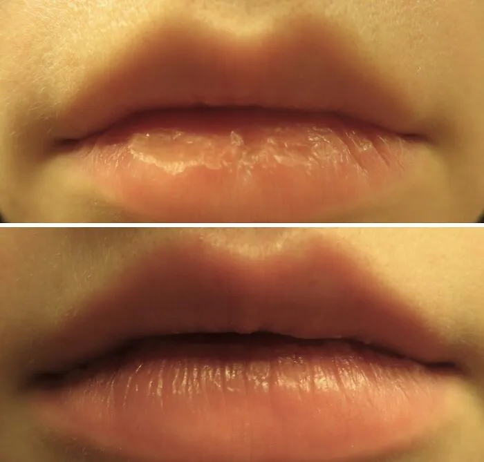 <span Style="Font:inherit;color:#d74b1f;"> Laneige's Lip Treat</Span>: Sleep Your Way To Softness With Antioxidants & Vit C!