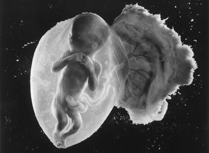 19 Groundbreaking Images By This Photographer Offering A Glimpse Into The Miracle Of Birth