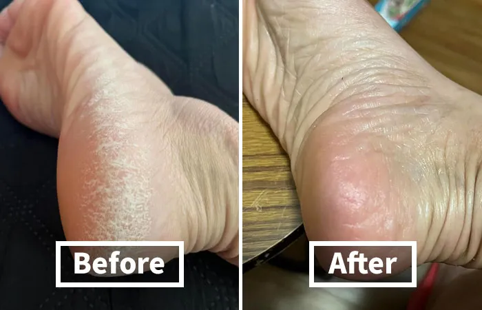 <span Style="Font:inherit;color:#d74b1f;"> Lee Beauty</Span>: The Home Pedicure Foot Spa You Need