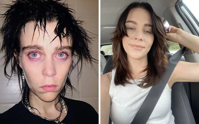 Foto 1: enero de 2020, foto 2: octubre de 2023. Ahora tengo 31 años y estoy sobria