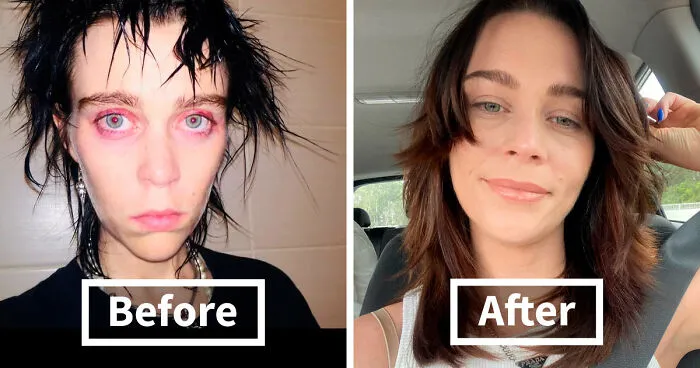 50 Before And After Pictures That Show What Happens When People Overcome Addiction (New Pics)