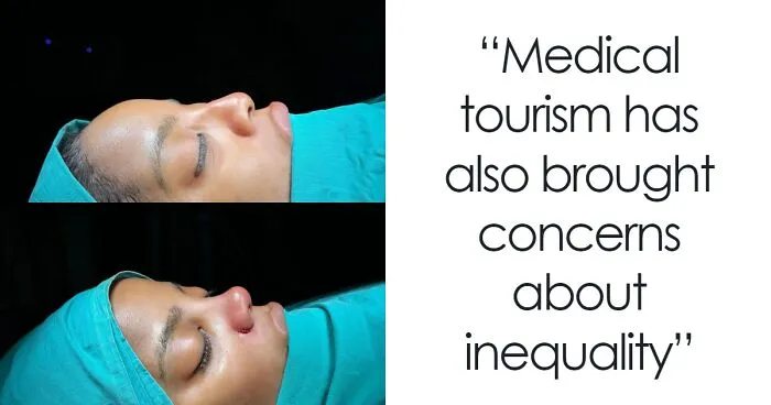 Activists Share Before And After Photos Of Their “Cheaper” Plastic Surgeries In Turkey