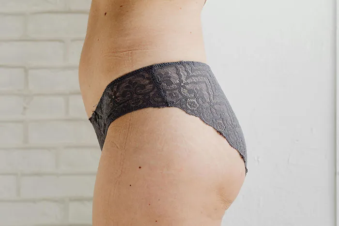 40 People Share The Weirdest Things About Their Bodies