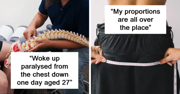 40 People Share The Weirdest Things About Their Bodies