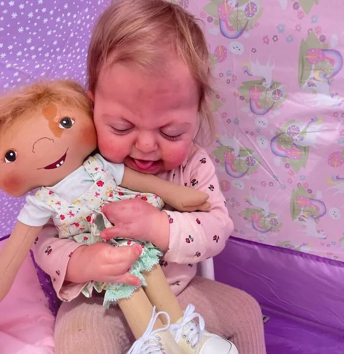 Woman Creates Inclusive Dolls Representing Their Owners That Face Rare Health Conditions (30 Pics)