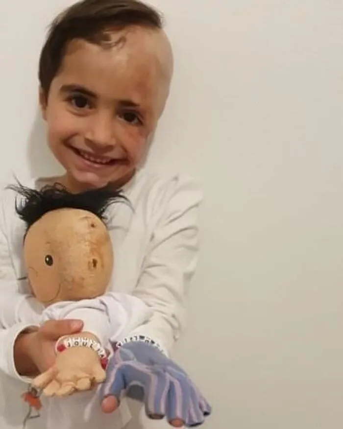Woman Creates Inclusive Dolls Representing Their Owners That Face Rare Health Conditions (30 Pics)