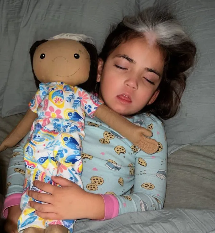 Woman Creates Inclusive Dolls Representing Their Owners That Face Rare Health Conditions (30 Pics)